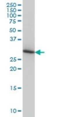 Western Blot: ARPC2 Antibody (5C8) [H00010109-M01]