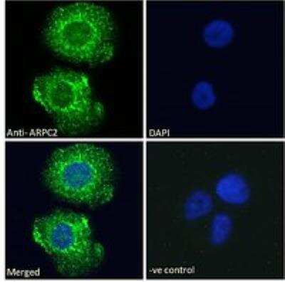Immunocytochemistry/ Immunofluorescence: ARPC2 Antibody [NB100-1037]