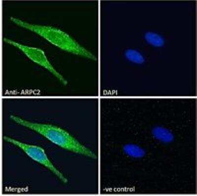Immunocytochemistry/ Immunofluorescence: ARPC2 Antibody [NB100-1037]