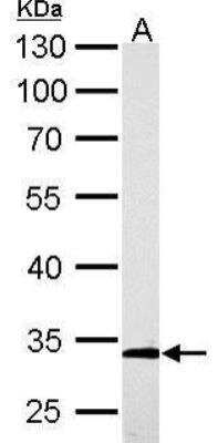 Western Blot: ARPC2 Antibody [NBP1-32297]