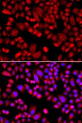 Immunocytochemistry/ Immunofluorescence: ARPC3 Antibody - BSA Free [NBP2-92679]