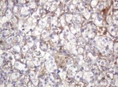 Immunohistochemistry: ARPC5 Antibody (OTI2G1) [NBP2-45504]