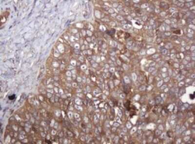 Immunohistochemistry: ARPC5 Antibody (OTI2G1) [NBP2-45504]