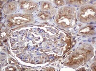 Immunohistochemistry: ARPC5 Antibody (OTI2G1) [NBP2-45504]