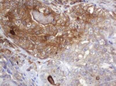 Immunohistochemistry: ARPC5 Antibody (OTI2G1) [NBP2-45504]