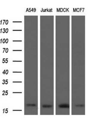 Western Blot: ARPC5 Antibody (OTI2G1) [NBP2-45504]