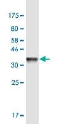 Western Blot: ARPM1 Antibody (2H8) [H00084517-M01-100ug]