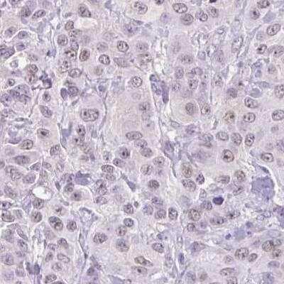 Immunohistochemistry-Paraffin: ARPM1 Antibody [NBP2-34022]