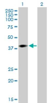 Western Blot: ARPM1 Antibody [H00084517-B01P]