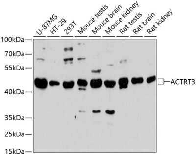 Western Blot: ARPM1 AntibodyAzide and BSA Free [NBP2-92111]