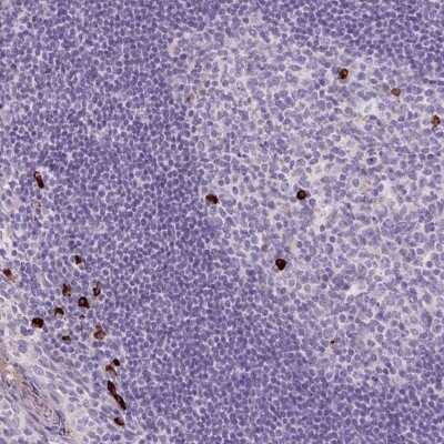 Immunohistochemistry: ARRDC2 Antibody [NBP2-47547]