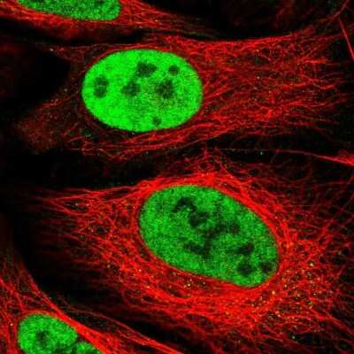 Immunocytochemistry/ Immunofluorescence: ARS2 Antibody [NBP2-13382]