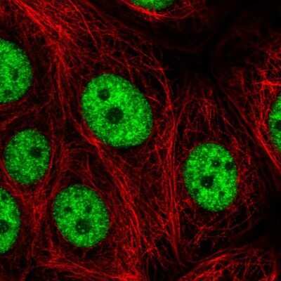 Immunocytochemistry/ Immunofluorescence: ARS2 Antibody [NBP2-58433]