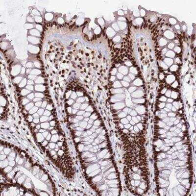 Immunohistochemistry-Paraffin: ARS2 Antibody [NBP2-13382]