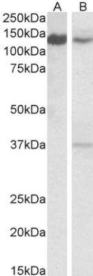 Western Blot: ARS2 Antibody [NBP2-42501]