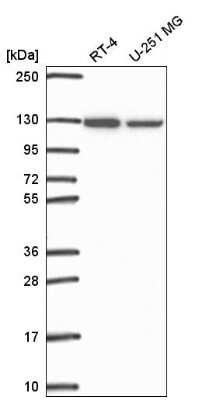 Western Blot: ARS2 Antibody [NBP2-58433]