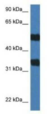 Western Blot: Arylsulfatase G/ARSG Antibody [NBP1-79576]