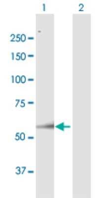 Western Blot: ARSH Antibody [H00347527-B01P]