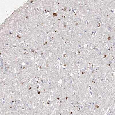 Immunohistochemistry-Paraffin: ARSI Antibody [NBP1-83678]