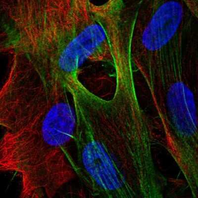Immunocytochemistry/ Immunofluorescence: ARSJ Antibody [NBP2-48658]