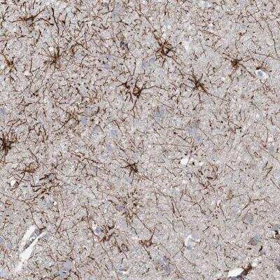 Immunohistochemistry: ARSJ Antibody [NBP1-82070]