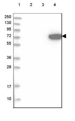 Western Blot: ARSJ Antibody [NBP2-48658]