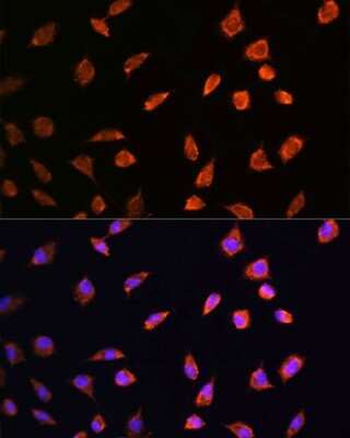Immunocytochemistry/ Immunofluorescence: ART1 Antibody - BSA Free [NBP2-91995]