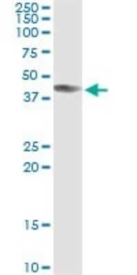 Immunoprecipitation: ART3 Antibody (1D2) [H00000419-M09]
