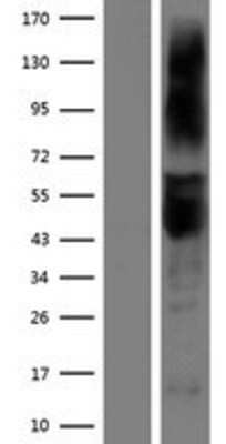 Western Blot: ART3 Overexpression Lysate [NBP2-09497]