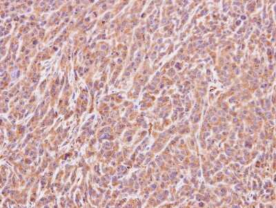 Immunohistochemistry-Paraffin: ART5 Antibody [NBP1-32664]