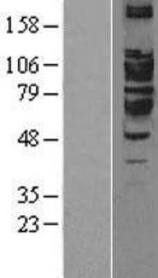 Western Blot: Aminopeptidase PILS/ARTS1 Overexpression Lysate [NBP2-04355]