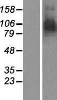 Western Blot: Aminopeptidase PILS/ARTS1 Overexpression Lysate [NBP2-11195]