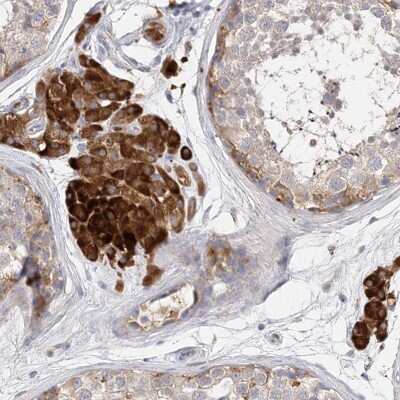 Immunohistochemistry-Paraffin: ARV1 Antibody [NBP2-48641]