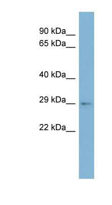 Western Blot: ARV1 Antibody [NBP1-59542]