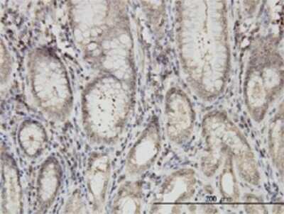Immunohistochemistry-Paraffin: ARVCF Antibody (5D2) [H00000421-M01]
