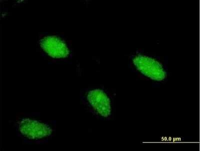 Immunocytochemistry/ Immunofluorescence: ARX Antibody (1G11) [H00170302-M03]