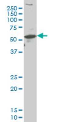 Western Blot: ARX Antibody (4A8) [H00170302-M08]