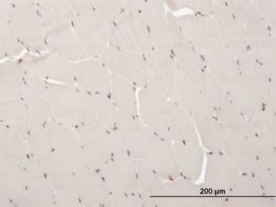 Immunohistochemistry-Paraffin: ARX Antibody (4H8) [H00170302-M04]