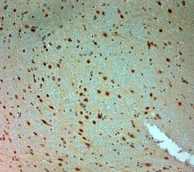 Immunohistochemistry-Paraffin: ARX Antibody [NBP2-80506]