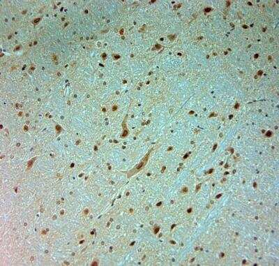 Immunohistochemistry-Paraffin: ARX Antibody [NBP2-80506]