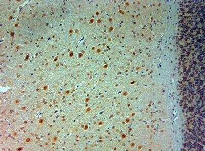 Immunohistochemistry-Paraffin: ARX Antibody [NBP2-80506]
