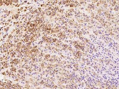 Immunohistochemistry-Paraffin: AS3MT Antibody [NBP2-97425]