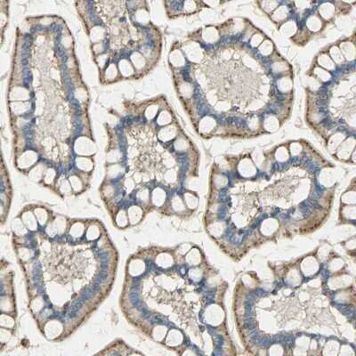 Immunohistochemistry-Paraffin: ASAH1 Antibody [NBP1-89296]