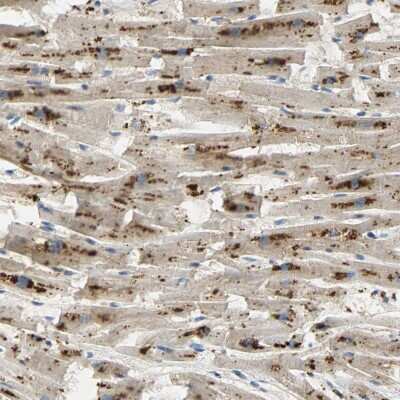 Immunohistochemistry-Paraffin: ASAH1 Antibody [NBP1-89296]