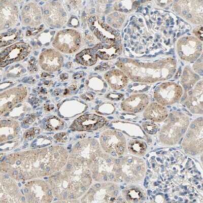 Immunohistochemistry-Paraffin: ASAH1 Antibody [NBP1-89296]
