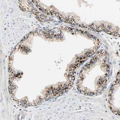 Immunohistochemistry-Paraffin: ASAH1 Antibody [NBP1-89296]