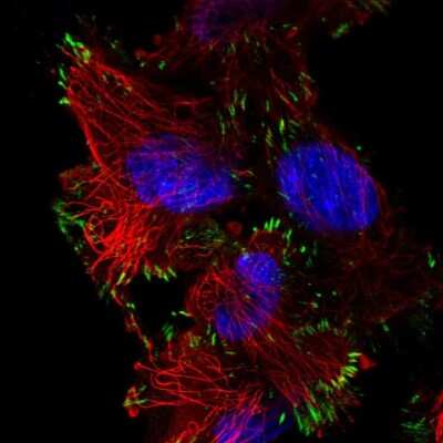 Immunocytochemistry/ Immunofluorescence: ASAH2/N-acylsphingosine Amidohydrolase-2 Antibody [NBP2-49326]
