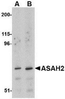 Western Blot: ASAH2/N-acylsphingosine Amidohydrolase-2 AntibodyBSA Free [NBP1-76360]
