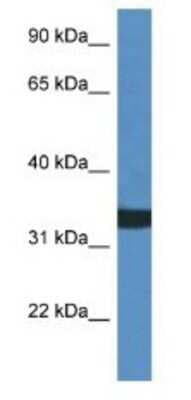 Western Blot: ASAH3 Antibody [NBP1-74083]