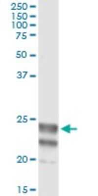 Immunoprecipitation: ASAHL/N-acylethanolamine-hydrolyzing Acid Amidase Antibody (3F4) [H00027163-M02]